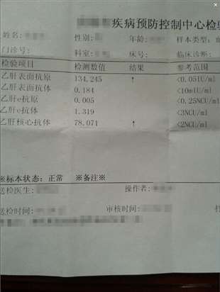 乙肝两对半1，5项呈阳性，HBV-DNA定量检测2*10的三次方请问严重吗？肝功能正常，B超正常。