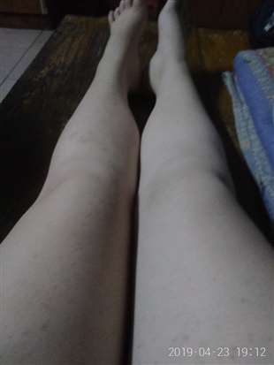 我的腿，白吗？