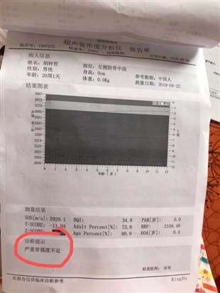 4个月宝宝超声骨密度分析 严重骨强度不足