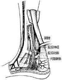 脚部的肌腱是指的那个部位？