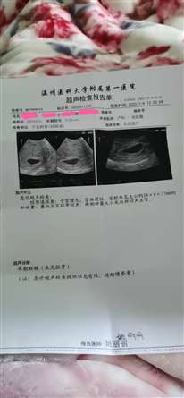 孕酮31.23人绒毛膜36411孕囊2公分了没见胚芽怎么办